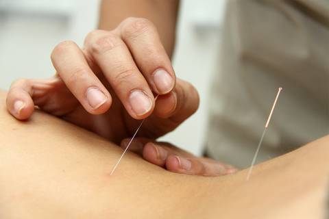 10% Acupuntura